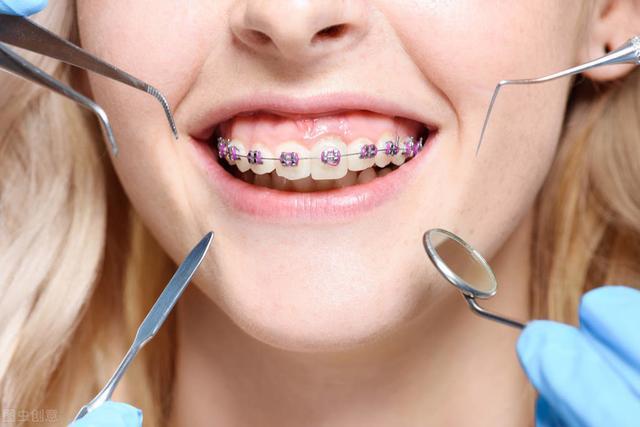 儿童牙齿矫正,几岁开始好?专家告诉你解决方案